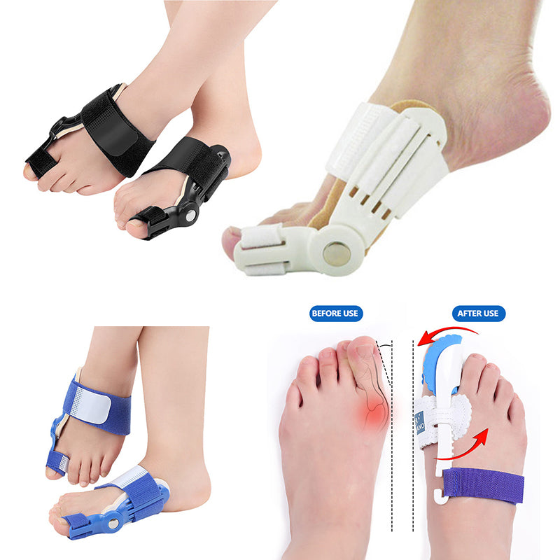 تصحيح إصبع القدم الطبّية
